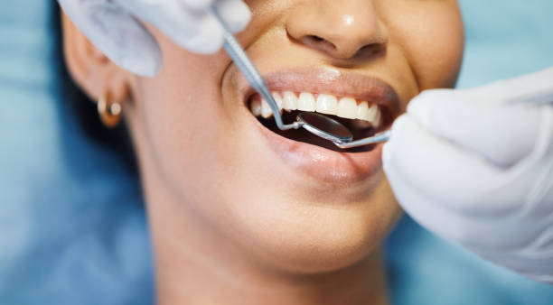 Best Urgent Care for Lost Fillings or Crowns in Lansdowne, MD